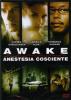 Awake. Anestesia cosciente