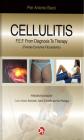 Cellulitis. From diagnosis to theraphy of the F.E.F.