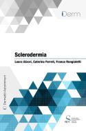 Ebook Sclerodermia di Atzori Laura, Ferreli Caterina, Rongioletti Franco edito da SICS