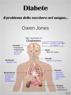 Ebook Diabete di Owen Jones edito da Tektime