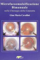Microfacoemulsificazione bimanuale nella chirurgia della cataratta di Gian Maria Cavallini edito da Athena Audiovisuals