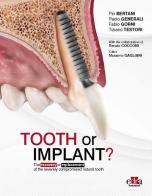 Tooth or Implant? The recovery or replacement of the severely compormised natural tooth di Pio Bertani, Paolo Generali, Fabio Gorni edito da Edra