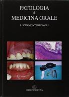 Patologia e medicina orale di Lucio Montebugnoli edito da Martina