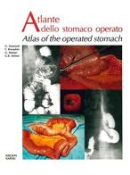 Atlante dell'intestino crasso operato-Atlas of the operated large bowel edito da Idelson-Gnocchi