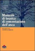 Manuale di tecnica di cementazione dell'anca edito da Timeo