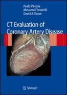 CT evaluation of coronary artery disease di Paolo Pavone, Massimo Fioranelli, David A. Dowe edito da Springer Verlag