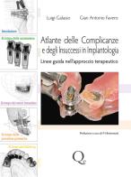 Atlante delle complicanze e degli insuccessi in implantologia. Linee guida nell'approccio terapeutico di Luigi Galasso, Gian Luigi Favero edito da Quintessenza