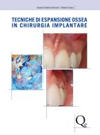 Tecniche di espansione ossea in chirurgia implantare di Giovanni Battista Bruschi, Roberto Crespi edito da Quintessenza