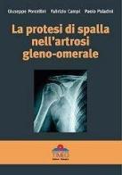 La protesi di spalla nell'artrosi gleno-omerale di Giuseppe Porcellini, Fabrizio Campi, Paolo Paladini edito da Timeo