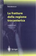 Le fratture della regione trocanterica di Pietro Maniscalco edito da Springer Verlag