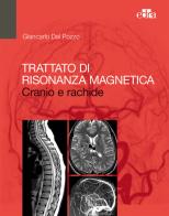 Trattato di risonanza magnetica. Cranio e rachide di Giancarlo Dal Pozzo edito da Edra