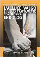 L' alluce valgo e il suo trattamento con tecnica endolog di Giovanni Maselli, Giuseppe Ferrara edito da Timeo