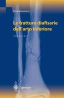 Le fratture diafisarie dell'arto inferiore di Pietro Maniscalco edito da Springer Verlag