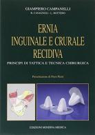 Ernia inguinale e crurale recidiva. Con videocassetta di Giampiero Campanelli edito da Minerva Medica