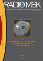 L' imaging della lesione muscolare acuta di Eugenio Genovese edito da Timeo
