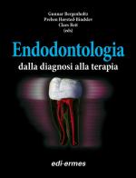 Endodontologia. Dalla diagnosi alla terapia di Gunnar Bergenholtz, Preben Horsted-Bindslev, Claes Reit edito da Edi. Ermes