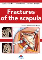 Fractures of the scapula. Ediz. illustrata di Sergio Candiotto, Enrico Gervasi, Giuseppe Porcellini edito da Timeo