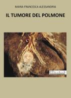 Il tumore nel polmone di Maria Francesca Alessandria edito da Youcanprint