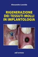 Rigenerazione dei tessuti molli in implantologia di Alessandro Leonida edito da Edi. Ermes