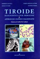 Tiroide. Diagnostica per immagini e approccio clinico ragionato edito da Idelson-Gnocchi