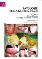 Patologie della mucosa orale di Pietro Messina, Giuseppe A. Scardina edito da Aracne