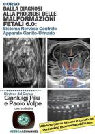 Dalla diagnosi alla prognosi delle malformazioni fetali 6.0 di Gianluigi Pilu, Paolo Volpe edito da Medicalchannel