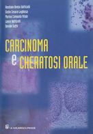 Carcinoma e cheratosi orale di Annibale Botticelli edito da La Goliardica Pavese