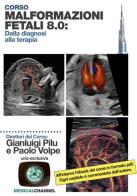 Malformazioni fetali 8.0: dalla diagnosi alla terapia di Gianluigi Pilu, Paolo Volpe edito da Medicalchannel