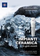 Impianti ceramica. La sfida vincente. Sistema implantare Zibone di Franco Giancola edito da Autopubblicato