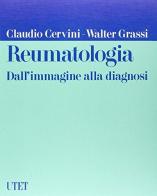 Reumatologia. Dall'immagine alla diagnosi di Claudio Cervini, Walter Grassi edito da UTET