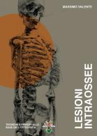 Lesioni intraossee. Tecniche e principi alla base dell'osteopatia di Massimo Valente edito da Un Altro Punto di Vista