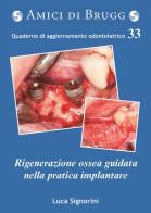 La rigenerazione ossea guidata nella pratica implantare di Luca Signorini edito da AdB Meeting