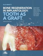 Bone regeneration in implantology: tooth as a graft di Elio Minetti edito da Edra