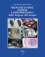 Neoplasie di rene, surrene e retroperitioneo: dalla diagnosi alla terapia edito da Poletto Editore