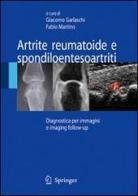 Artrite reumatoide e spondiloentesoartriti edito da Springer Verlag
