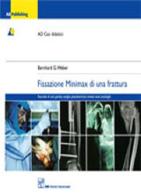 Fissazione minimax di una frattura di Bernhard G. Weber edito da CIC Edizioni Internazionali