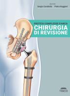 Protesi complesse d'anca. Chirurgia di revisione. Ediz. illustrata di Sergio Candiotto, Pietro Ruggieri edito da Timeo
