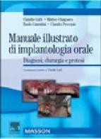 Manuale illustrato di implantologia orale. Diagnosi, chirurgia e protesi. Ediz. illustrata edito da Elsevier