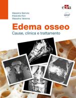 Edema osseo. Cause, clinica e trattamento di Massimo Berruto, Elizaveta Kon, Massimo Varenna edito da Edra
