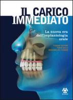 Il carico immediato. La nuova era dell'implantologia orale di Tiziano Testori, Fabio Galli, Massimo Del Fabbro edito da Acme (Viterbo)