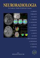 Neuroradiologia. Per studenti e medici di medicina generale edito da Idelson-Gnocchi