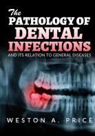 The pathology of dental infections and its relation to general diseases di Weston A. Price edito da StreetLib