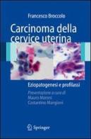 Carcinoma della cervice uterina. Eziopatogesi e profilassi di Francesco Broccolo edito da Springer Verlag