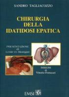 Chirurgia della idatidosi epatica di Sandro Tagliacozzo edito da EMSI