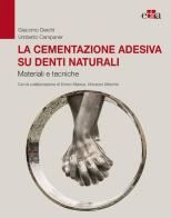 La cementazione adesiva su denti naturali. Materiali e tecniche di Giacomo Derchi, Umberto Campaner edito da Edra
