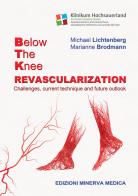 Below the knee revascularization. Challenges, current technique and future outlook di Michael Lichtenberg, Marianne Brodmann edito da Minerva Medica