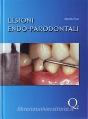 Lesioni endo-parodontali.pdf