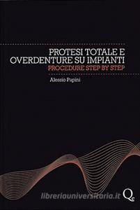 Protesi totale e overdenture su impianti. Procedure step by step.pdf