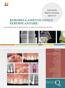 Rimodellamento osseo perimplantare: background scientifico e implicazioni cliniche.pdf