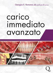 Carico immediato Avanzato.pdf